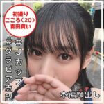 Thumbnail of related posts 170