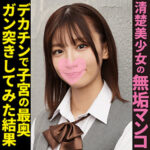 Thumbnail of related posts 166