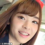 Thumbnail of related posts 179