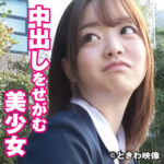 Thumbnail of related posts 180