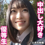 Thumbnail of related posts 154