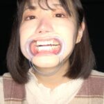 Thumbnail of related posts 071