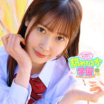 Thumbnail of related posts 113