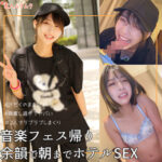 Thumbnail of related posts 180