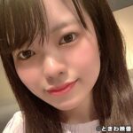 Thumbnail of related posts 100