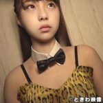 Thumbnail of related posts 199