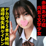 Thumbnail of related posts 190